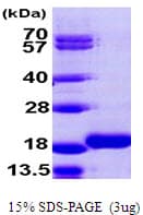 Human MAP1LC3B2 Protein (Recombinant His)