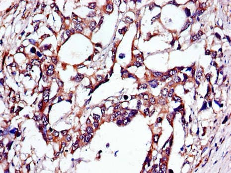 TUBA4A / TUBA1 Antibody