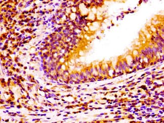 Polyclonal Rabbit anti-Human NCAM2 Antibody (IHC, WB)