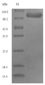 Human GLS2 / Glutaminase 2 Protein (Recombinant 6His-SUMO, N-terminus)