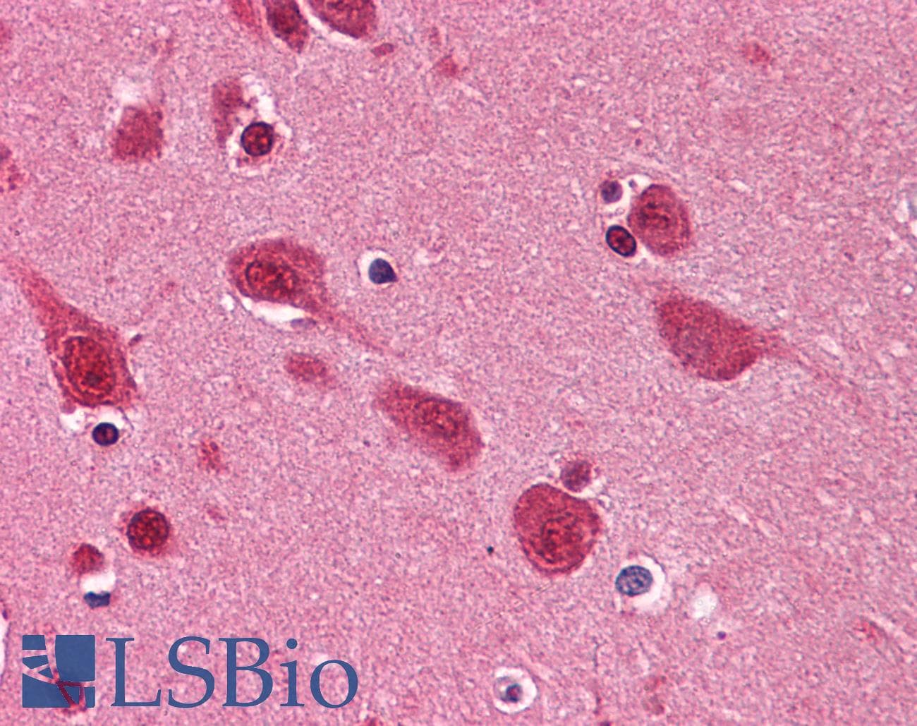 IHC-plus™ TDP-43 / TARDBP Antibody (clone 2E2-D3)