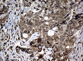 NBN / Nibrin Antibody (clone OTI3A2)