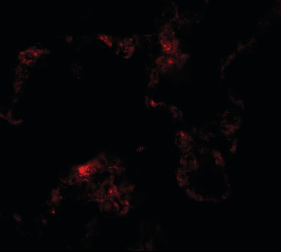 Polyclonal Rabbit anti-Human NBN / Nibrin Antibody (IHC, IF, WB)