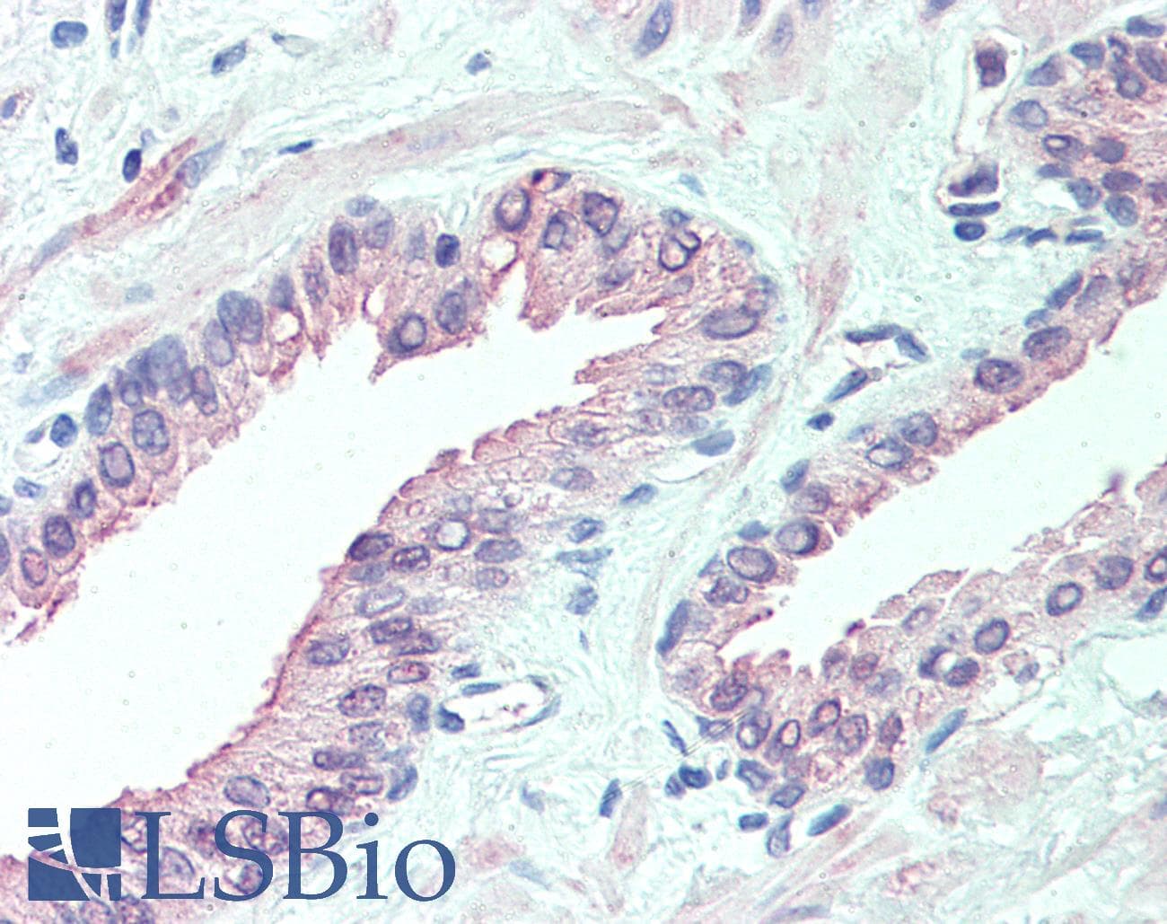 IHC-plus™ SLITRK6 Antibody (Internal)