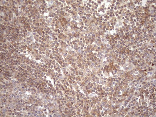 TNFRSF10B / Killer / DR5 Antibody (aa203-411, clone OTI2A5)