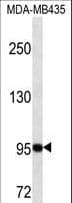 GSN / Gelsolin Antibody (aa230-259)