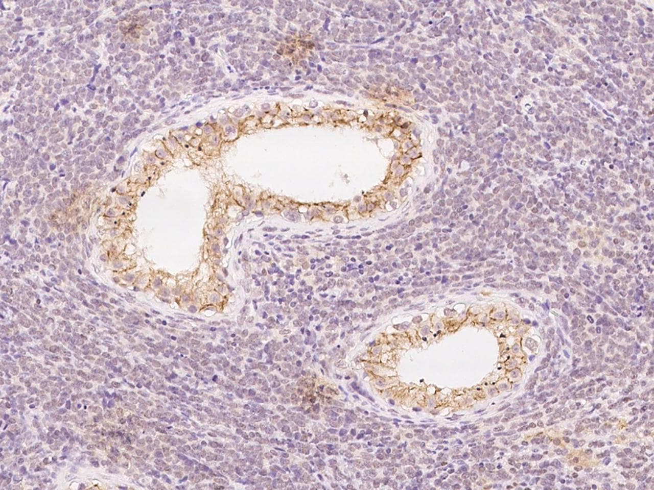 VPS26A / VPS26 Antibody