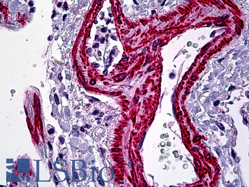 IHC-plus™ Polyclonal Rabbit anti-Human ACTA2 / Smooth Muscle Actin Antibody (N-Terminus, IHC)