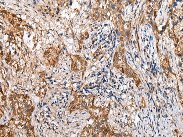 LYPD4 Antibody
