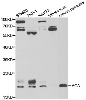 AGA / Aspartylglucosaminidase Antibody
