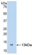 S100A8 / MRP8 Antibody (aa1-93)