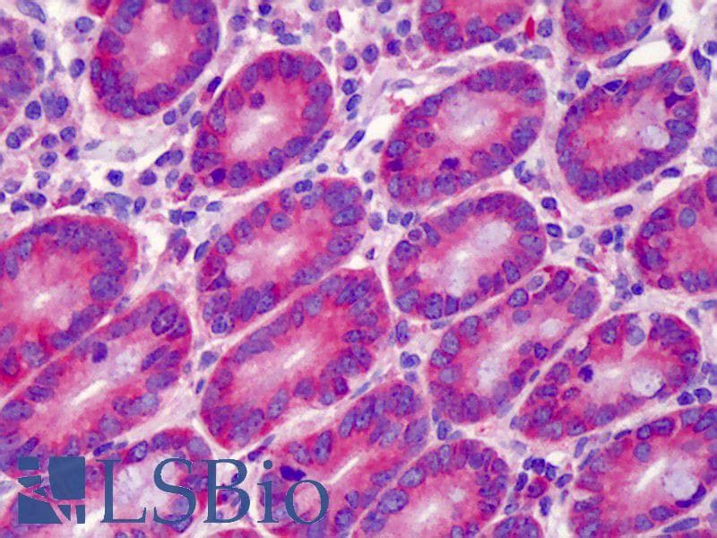 IHC-plus™ GPR52 Antibody (aa311-360)