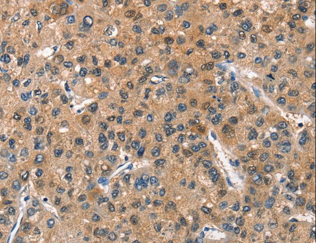 ASB2 Antibody