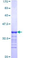 Human KLF3 Protein (Recombinant GST, N-terminus)