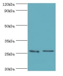 GSTM4-4 / GSTM4 Antibody (aa1-218)