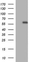 MMP13 Antibody (aa104-471, clone OTI2F4)