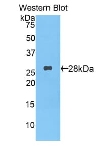 BAFF / TNFSF13B Antibody (aa68-302)