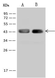 STX18 / Syntaxin 18 Antibody