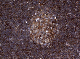 RASGRP3 / GRP3 Antibody (aa380-690, clone OTI2C11)