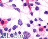 PathPlus™ FP / PTGFR Antibody (Extracellular Domain)