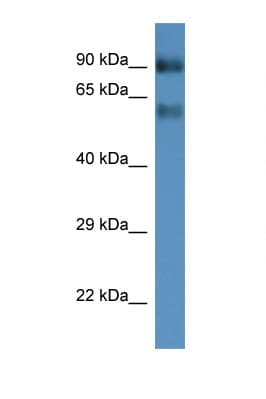 Polyclonal Rabbit anti-Mouse SLC6A15 / SBAT1 Antibody (aa400-449, WB)
