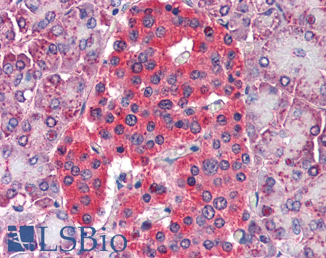 IHC-plus™ GLUD1/Glutamate Dehydrogenase Antibody
