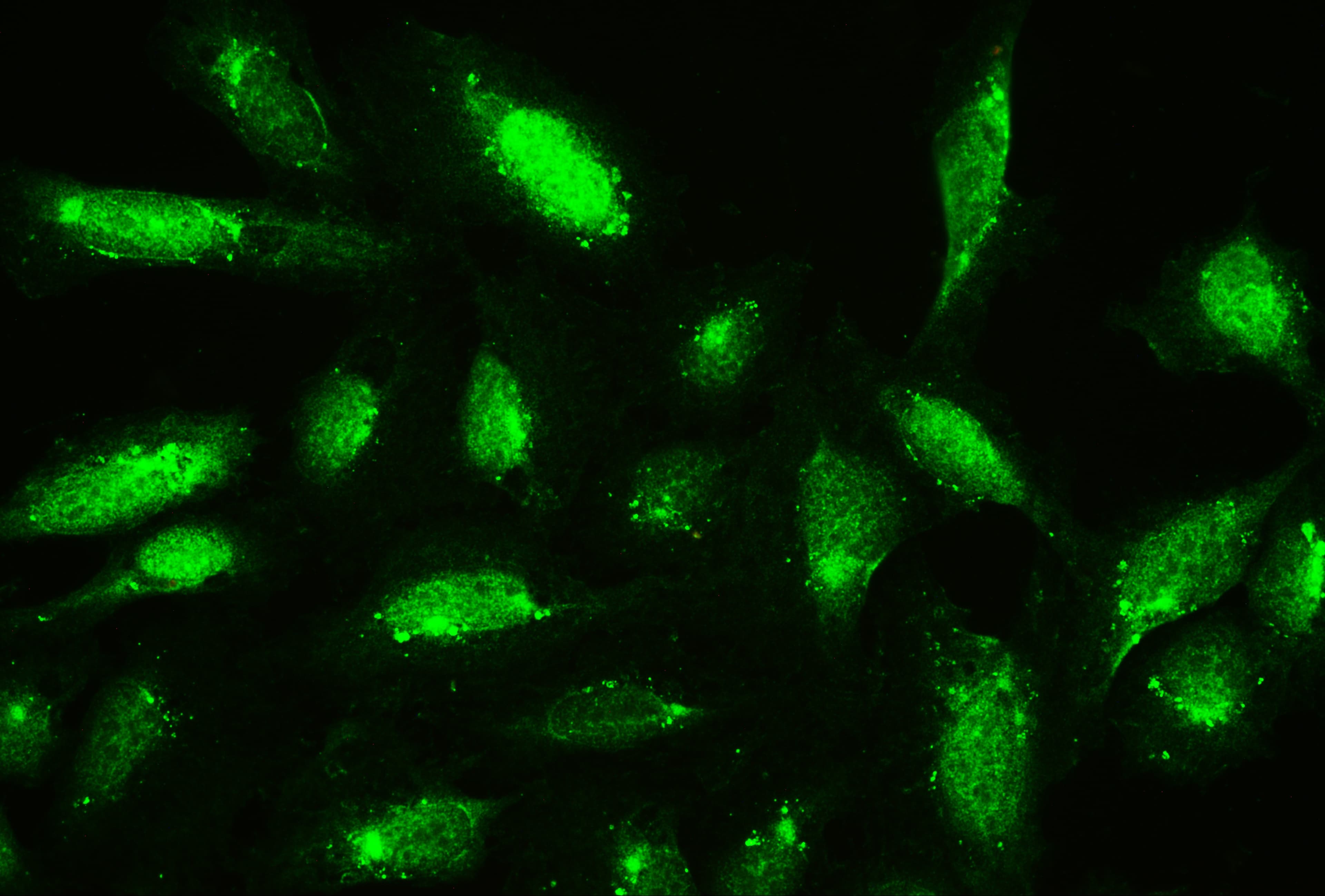 Polyclonal Rabbit anti-Human CFL1 / Cofilin Antibody (aa2-166, IHC, WB)