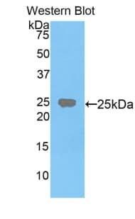 FDFT1 / Squalene Synthase Antibody (aa217-416, PE)