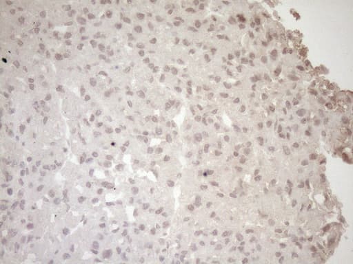 LAMB2 / Laminin Beta 2 Antibody (aa314-561, clone OTI3B4)