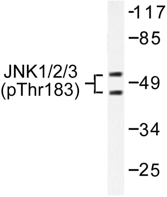 Polyclonal Rabbit anti-Human JNK1+2+3 Antibody (phospho-Thr183, WB)