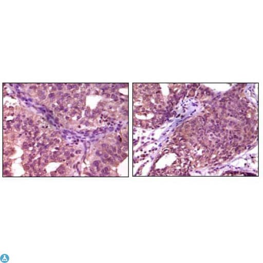 EPHA1 / EPH Receptor A1 Antibody