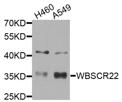 Polyclonal Rabbit anti-Human WBSCR22 Antibody (IHC, IF, WB)