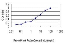 CCM1 / KRIT1 Antibody (clone 2C7)