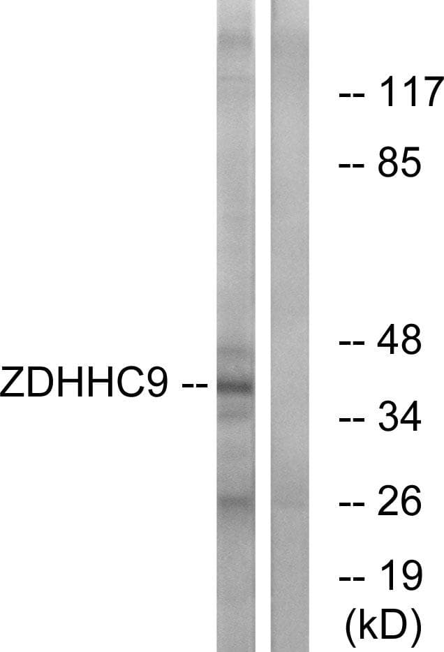 ZDHHC9 Antibody
