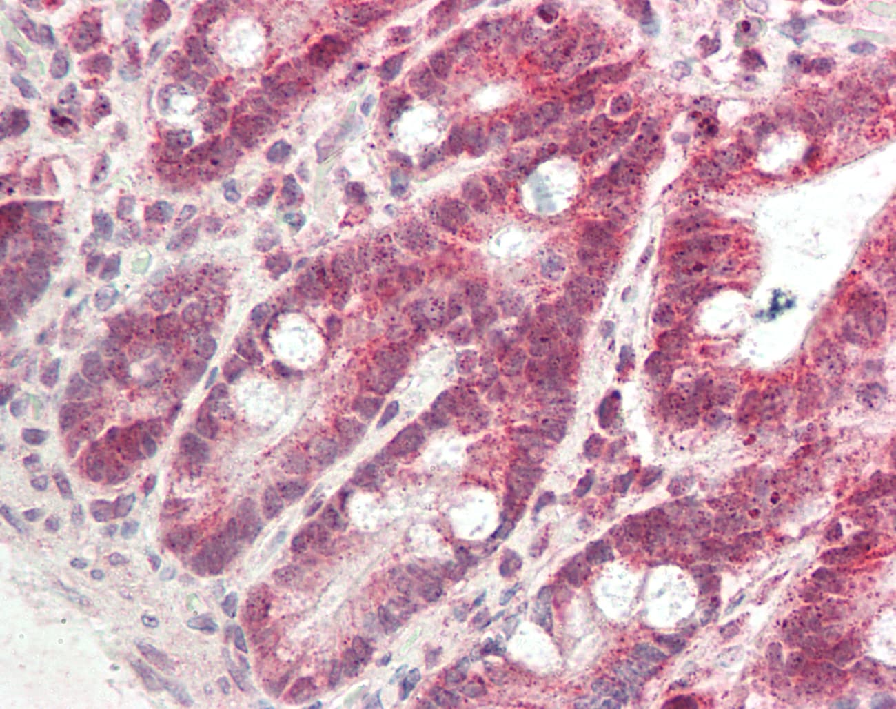 DDH / AKR1C1 Antibody (aa50-99)
