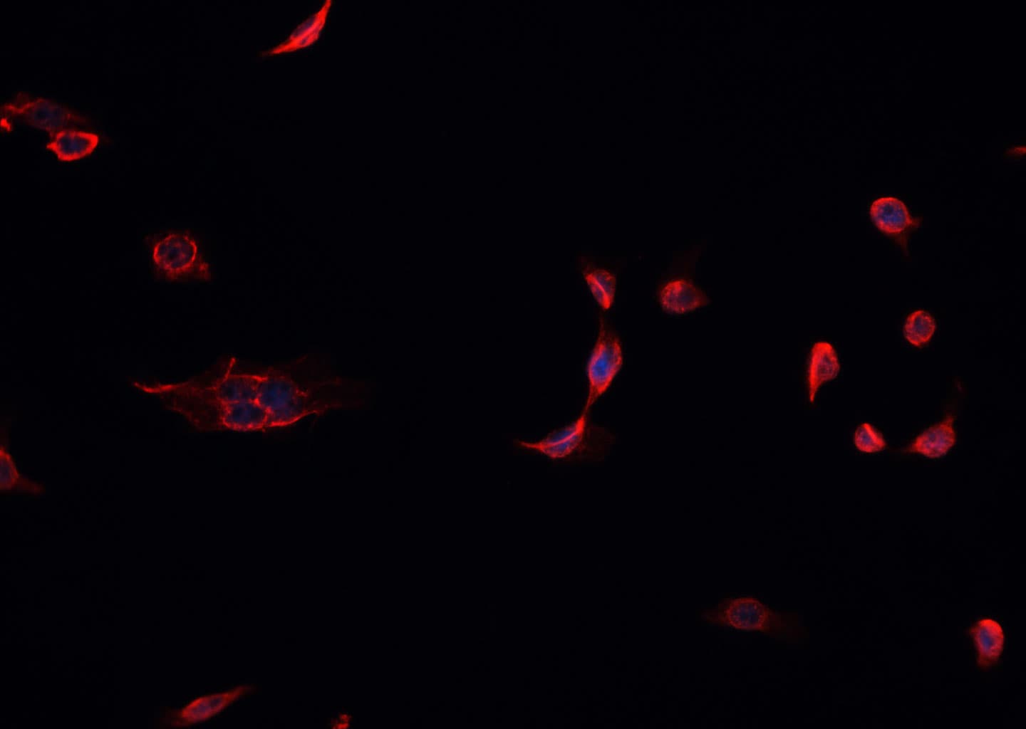 Polyclonal Rabbit anti-Human STK11 / LKB1 Antibody (IHC, IF, WB)