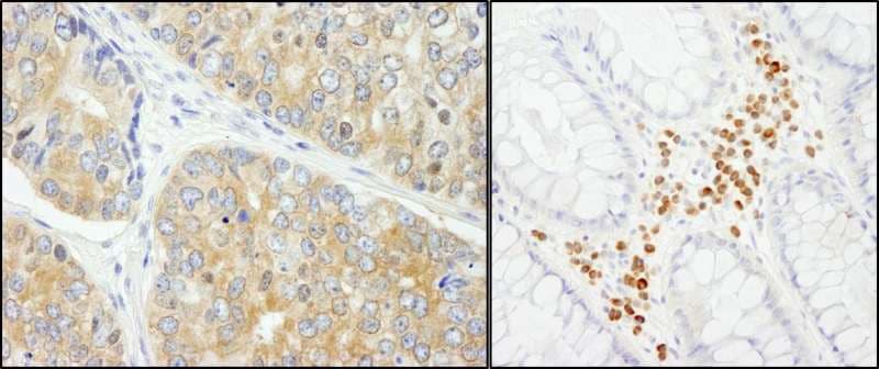Polyclonal Rabbit anti-Human PABPC4 Antibody (aa525-575, IHC, WB)