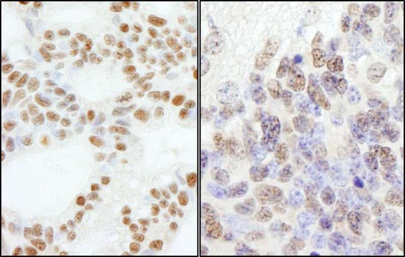 POLE3 / DNA Polymerase Epsilon Antibody (aa97-147)