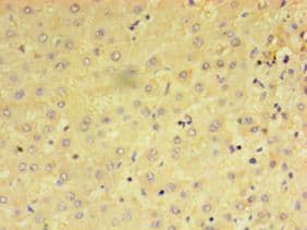 PRAME Antibody (aa1-509)