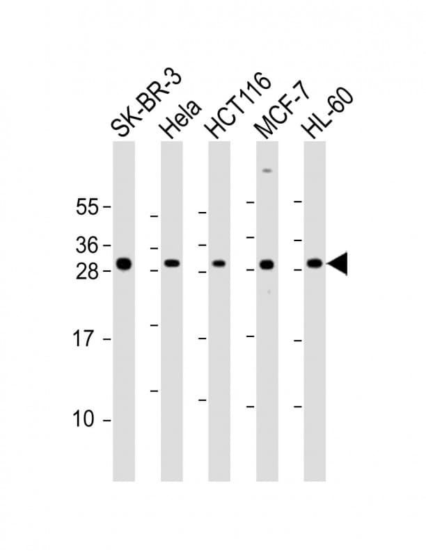 NAA10 / ARD1A Antibody (aa135-167)