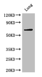BIRC3 / cIAP2 Antibody