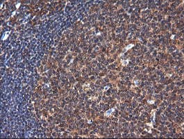 NDOR1 Antibody (clone OTI1E3)