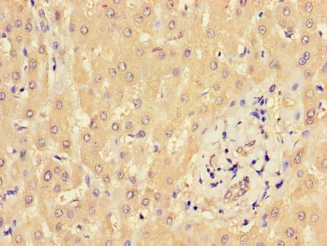 Polyclonal Rabbit anti-Human BBS9 Antibody (IHC, IF)