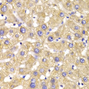 IHC-plus™ Polyclonal Rabbit anti-Human GPD2 Antibody (IHC, WB)