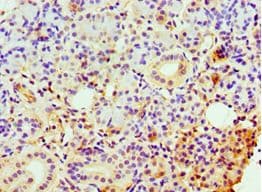 CLDN14 / Claudin 14 Antibody (aa140-239)