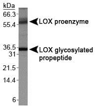 IHC-plus™ LOX / Lysyl Oxidase Antibody (aa118-168)