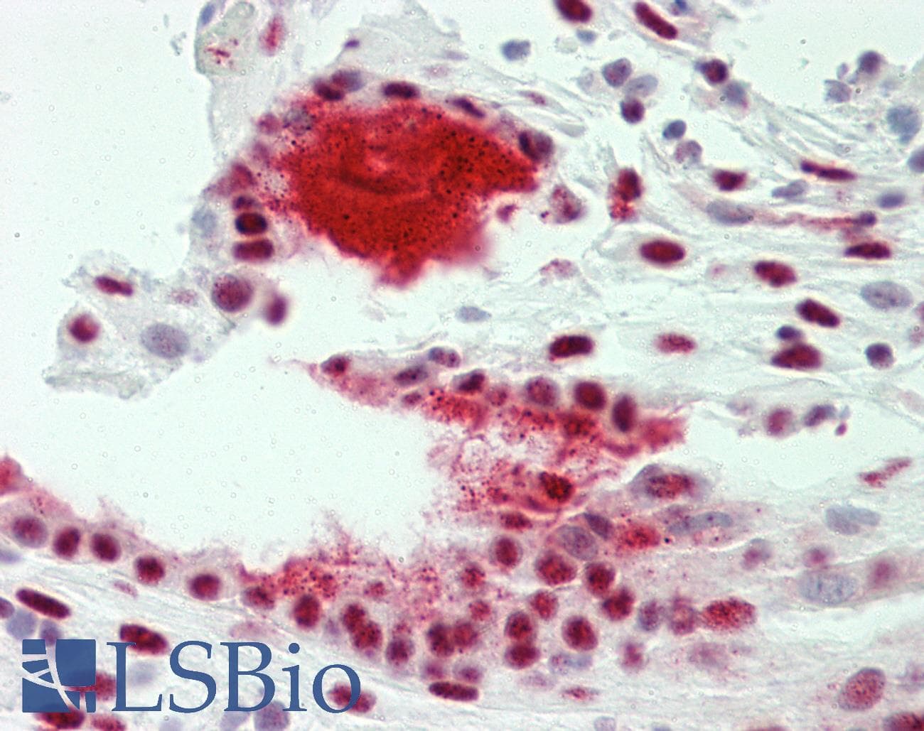 IHC-plus™ TROP2 / TACSTD2 Antibody (aa131-180)