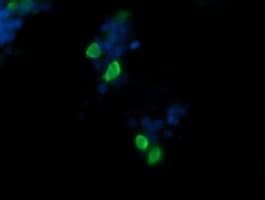 CCT8L2 Antibody (clone OTI1D12)