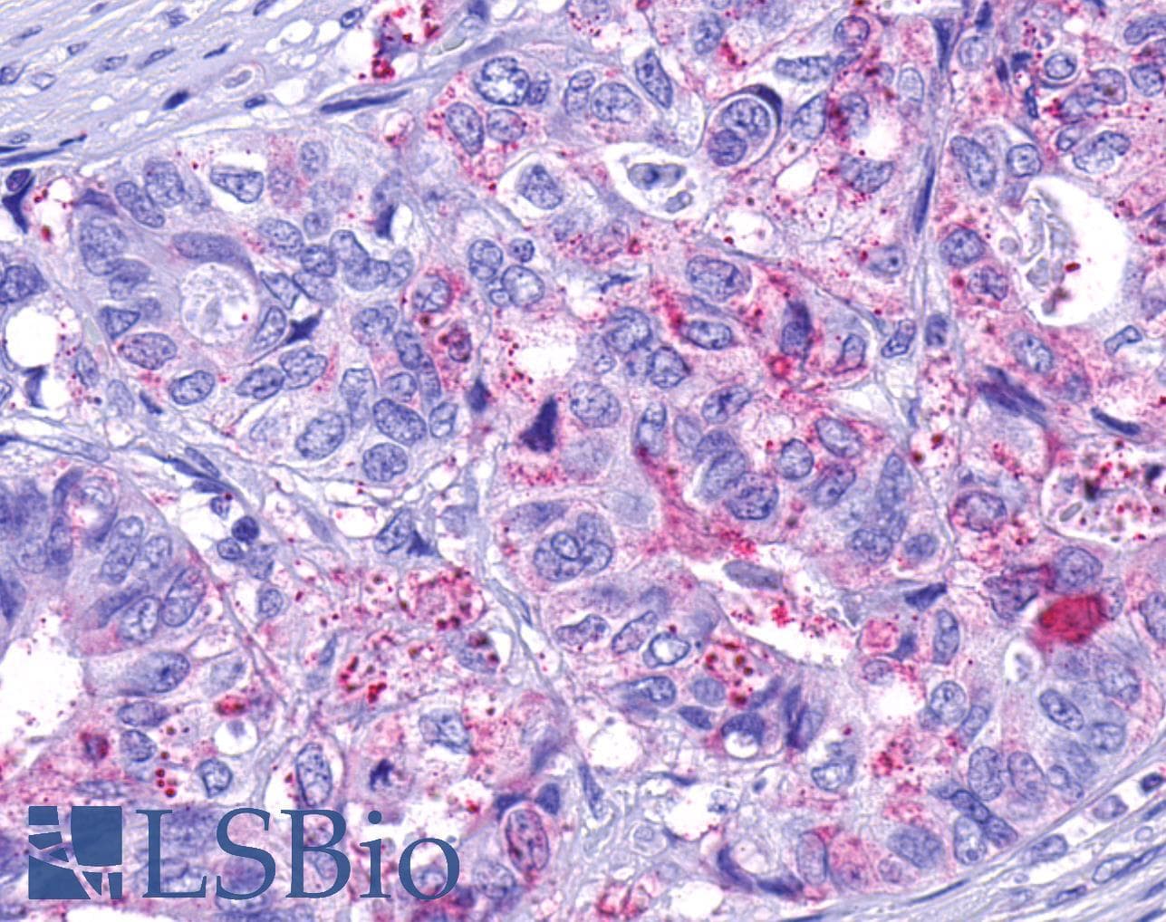 PathPlus™ F2R / Thrombin Receptor / PAR1 Antibody (N-Terminus)
