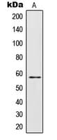 CRF2-12 / IL28RA Antibody (Internal)